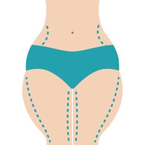 How to Tighten Skin on Thighs Naturally
