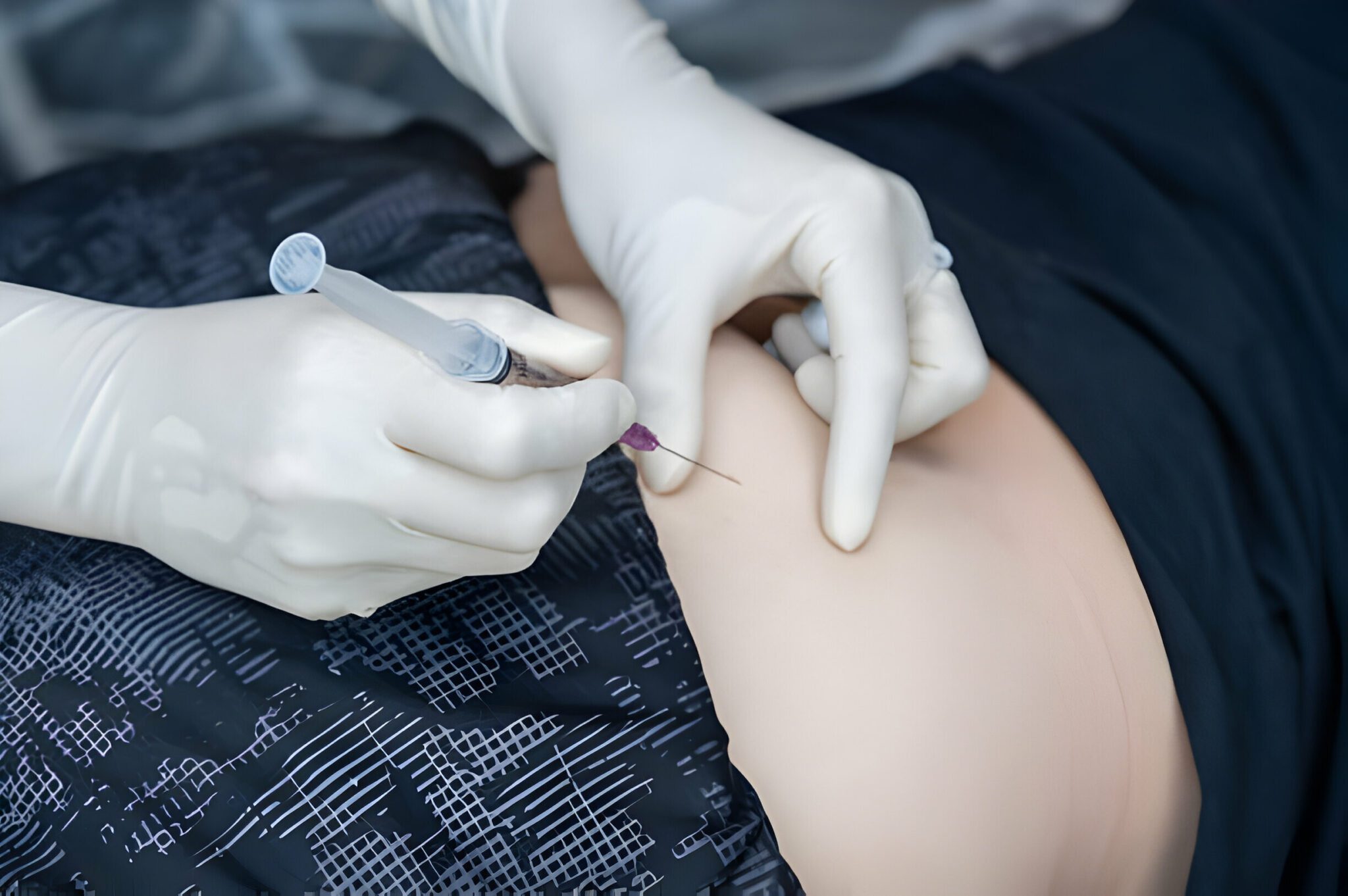 dermafill-injection-for-hips-and-bums-everything-you-need-to-know